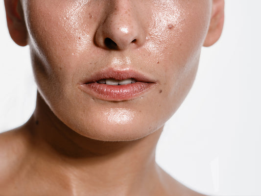 Top products & skin care options for oily skin