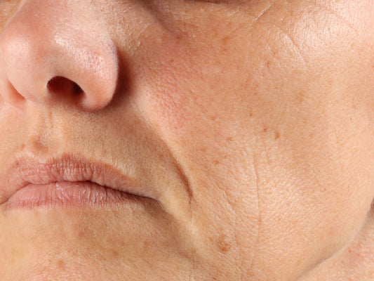 Understanding skin ageing